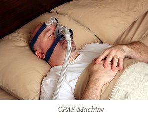 Dental Appliance vs CPAP Machine